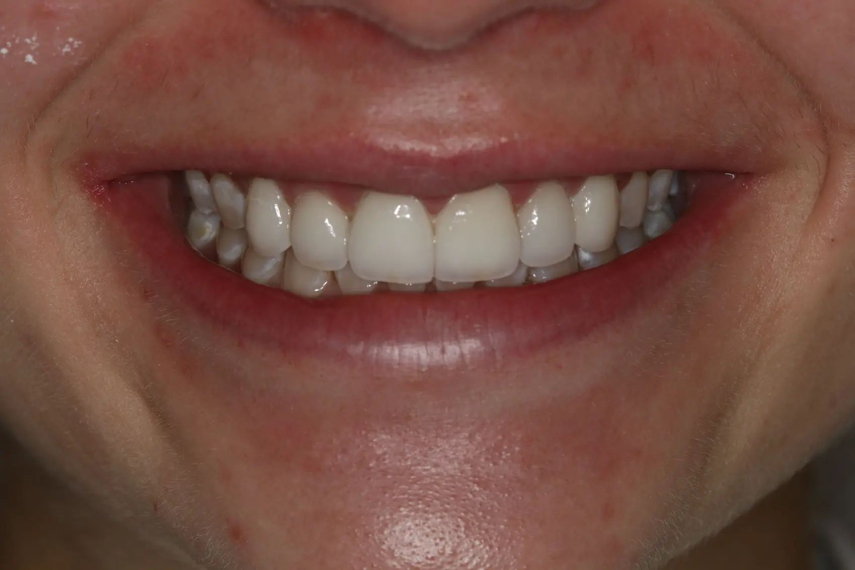 Georgetown Cosmetic Dentistry