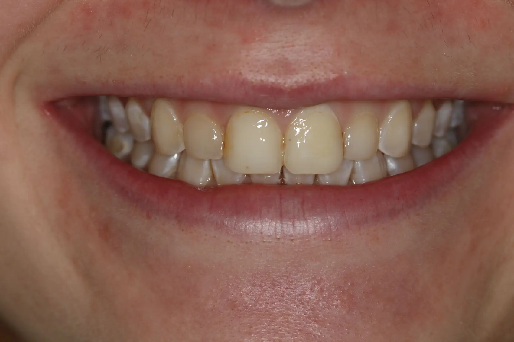 Georgetown Cosmetic Dentistry