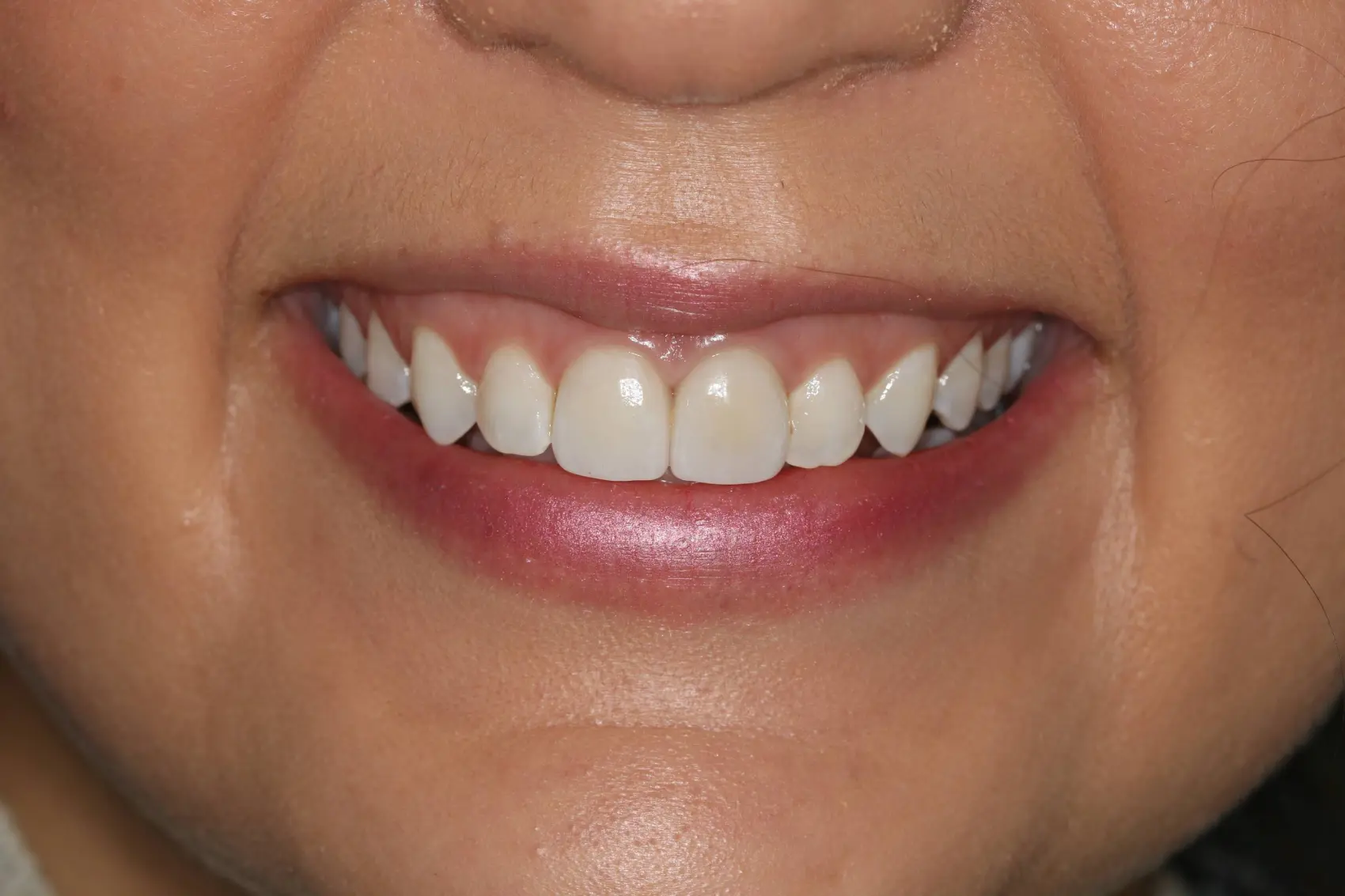 Georgetown Cosmetic Dentistry
