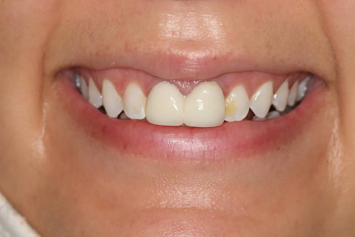 Georgetown Cosmetic Dentistry