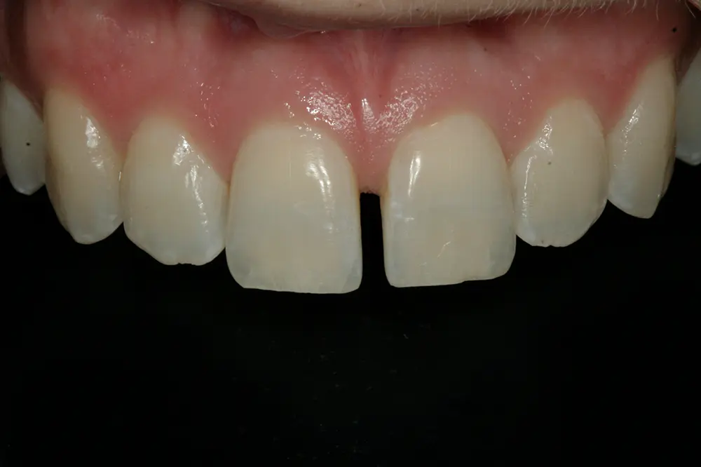 Georgetown Cosmetic Dentistry
