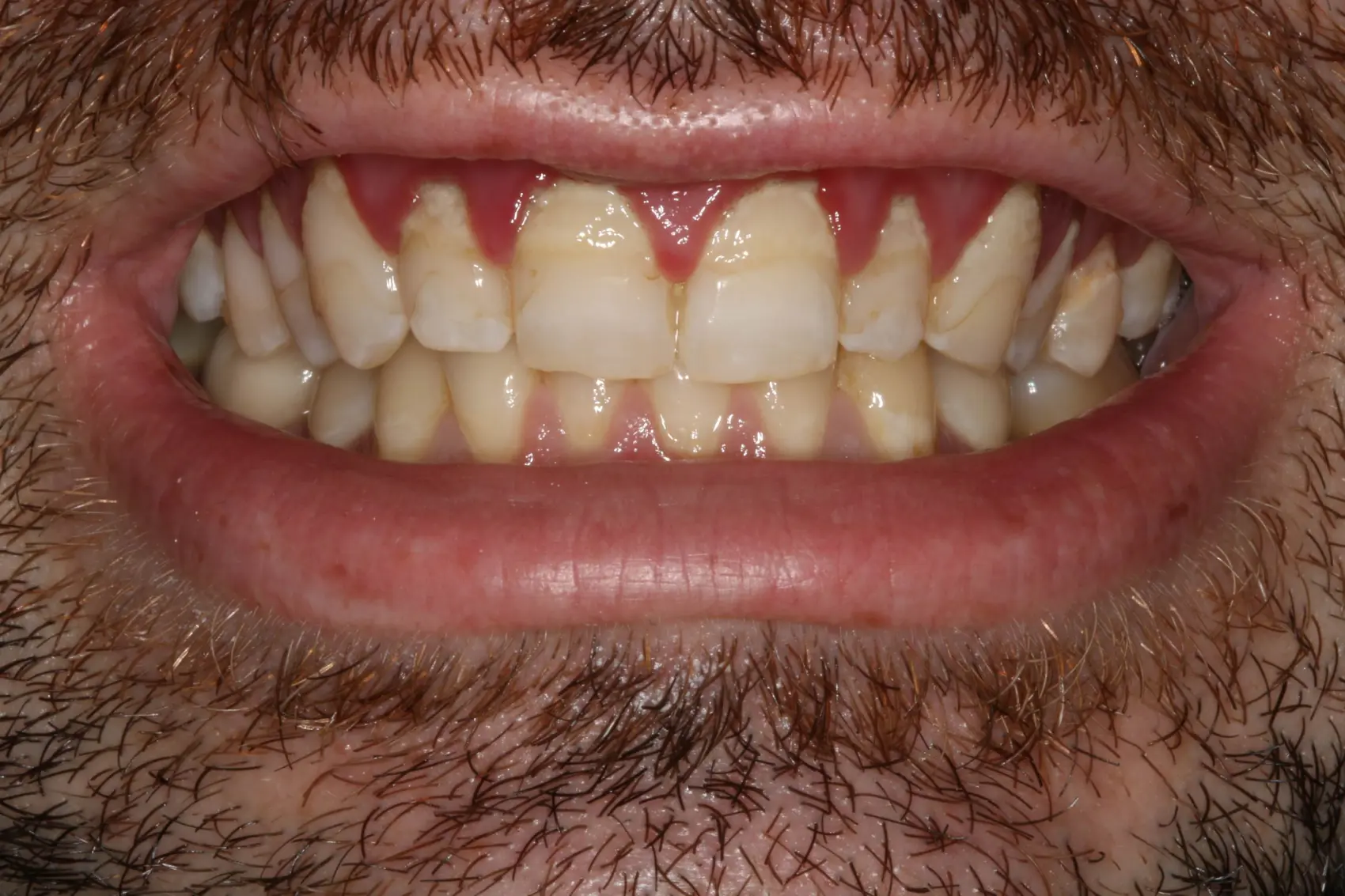 Georgetown Cosmetic Dentistry