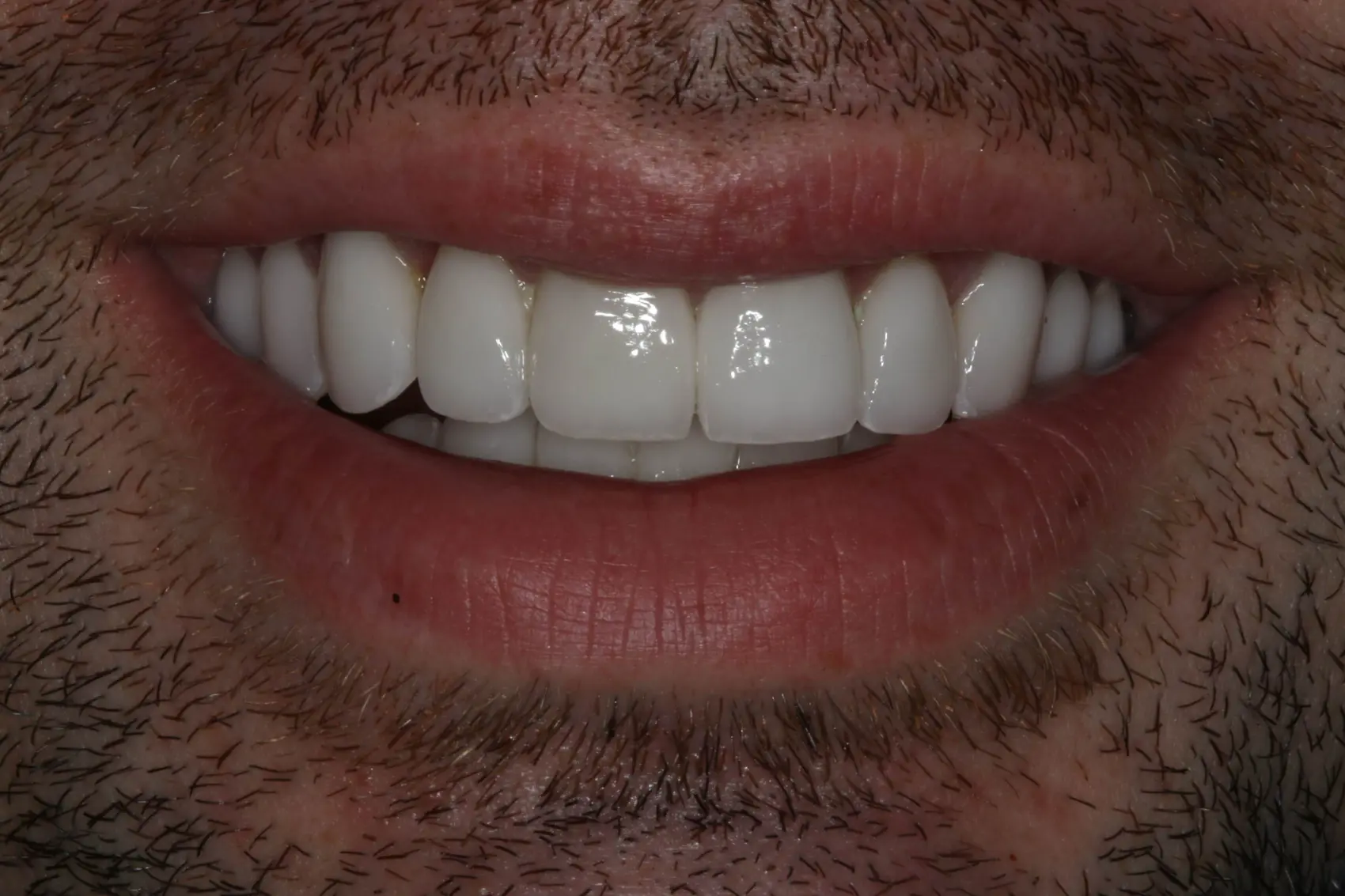 Georgetown Cosmetic Dentistry