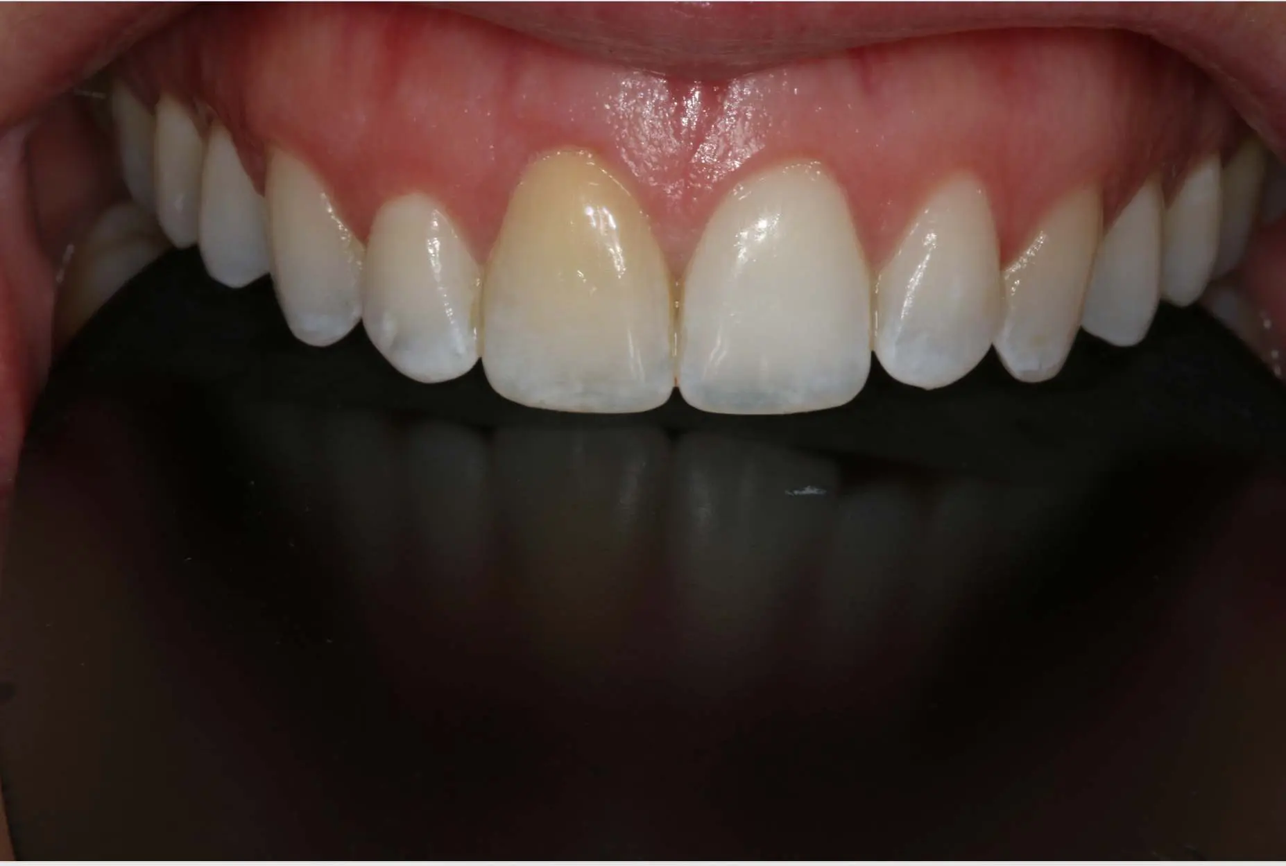 Georgetown Cosmetic Dentistry