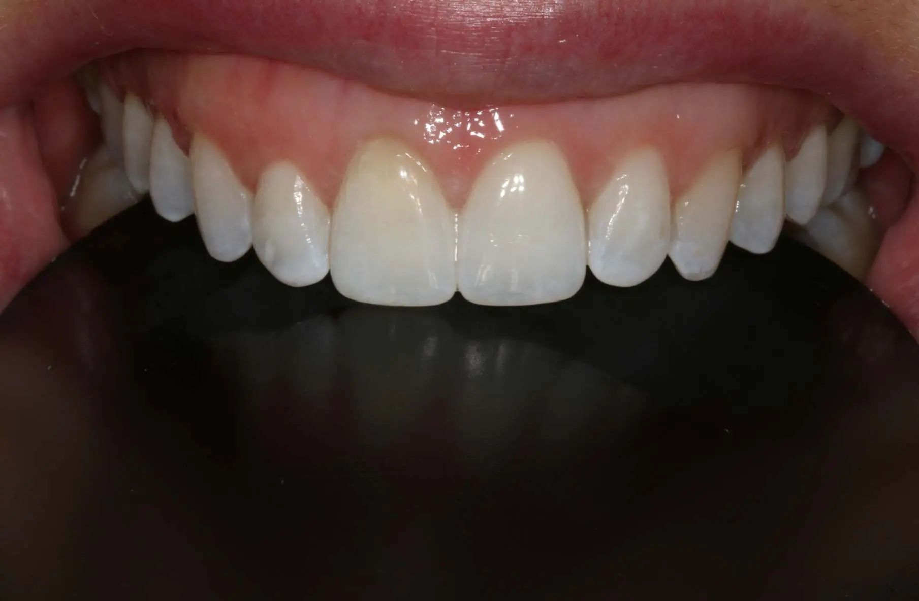 Georgetown Cosmetic Dentistry