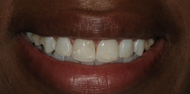 Georgetown Cosmetic Dentistry