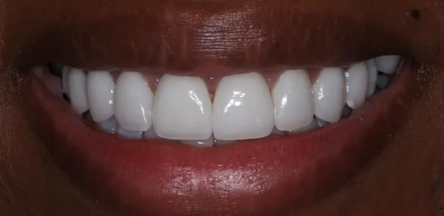 Georgetown Cosmetic Dentistry