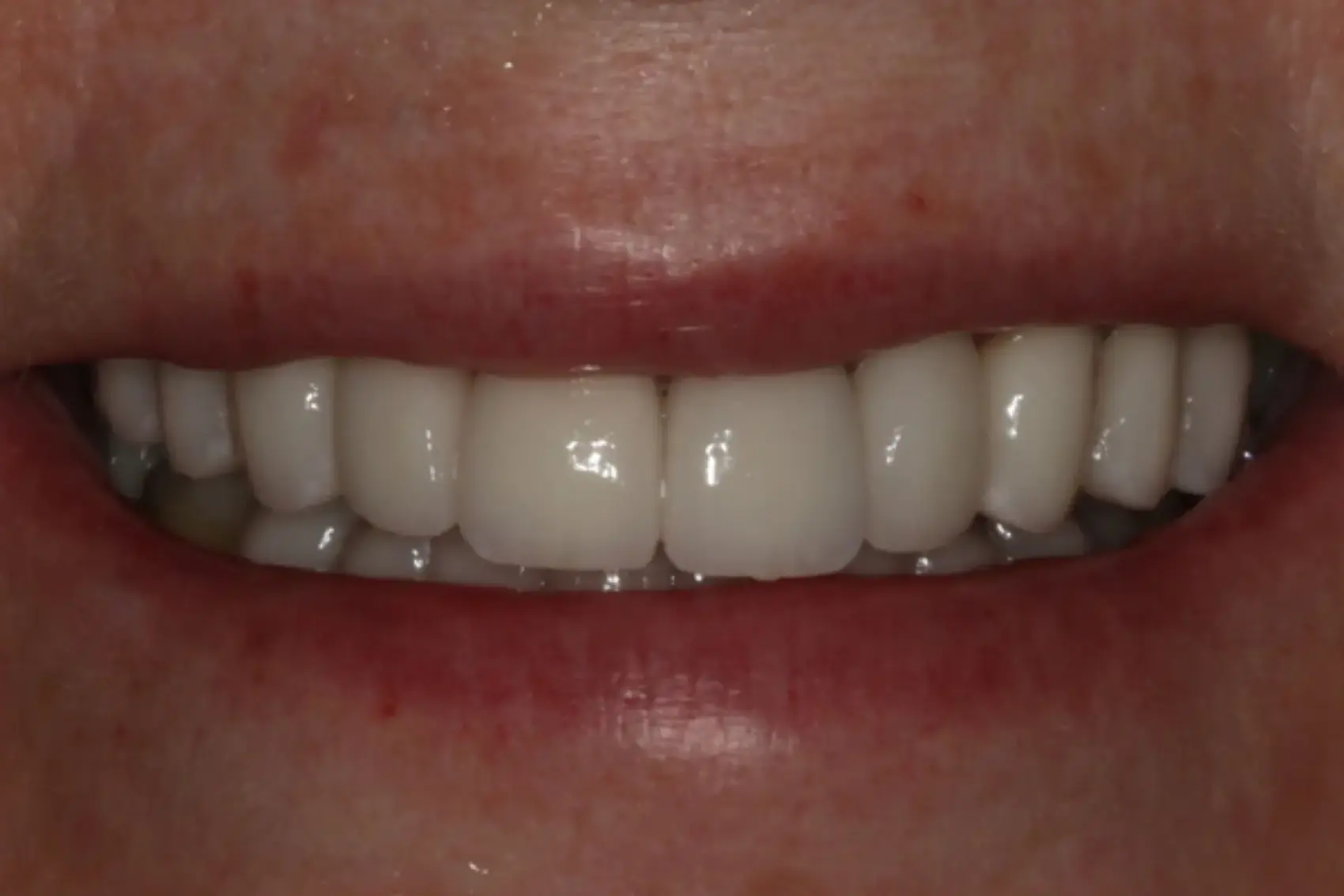 Georgetown Cosmetic Dentistry